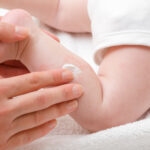 eczema in babies treatment