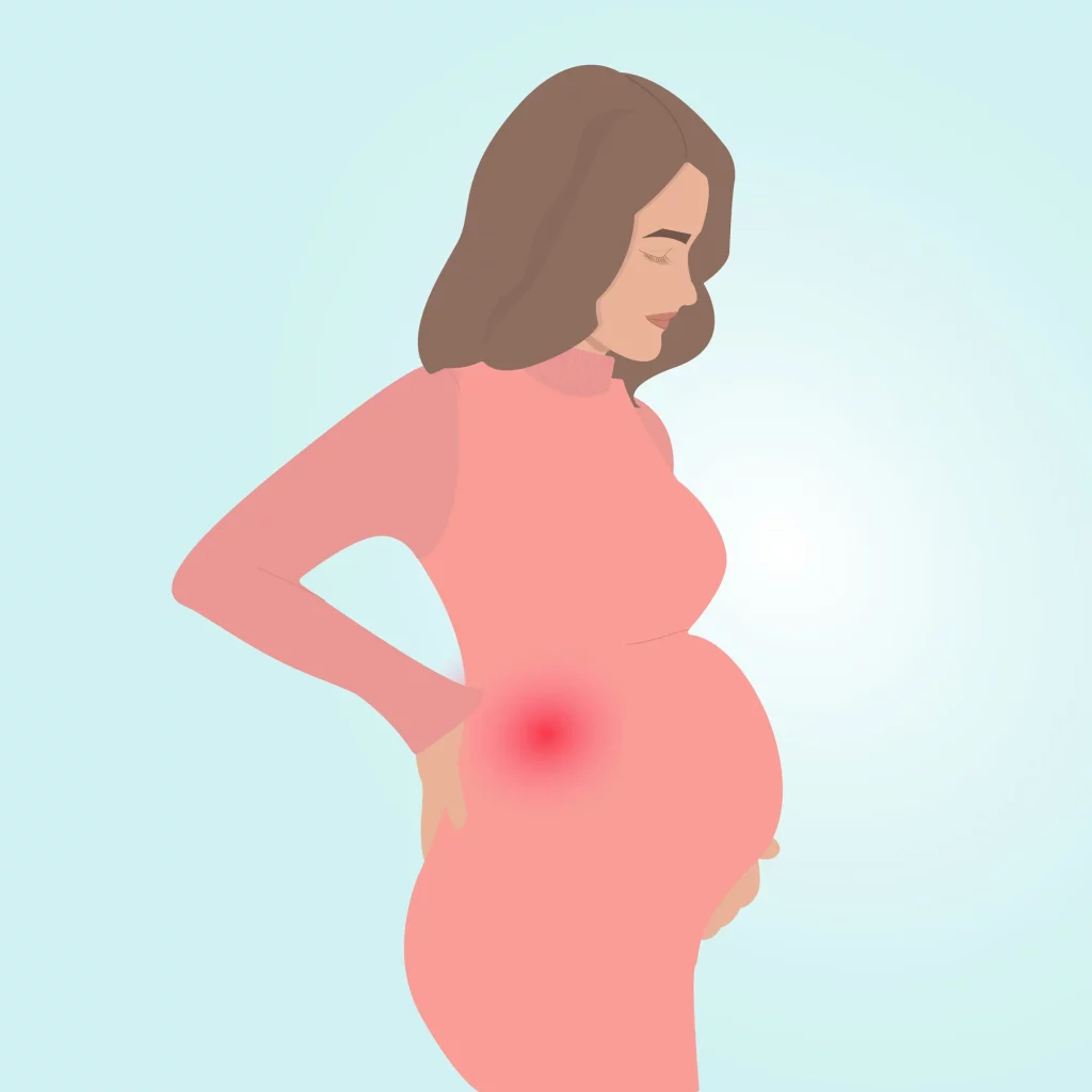 Back Pain During Pregnancy